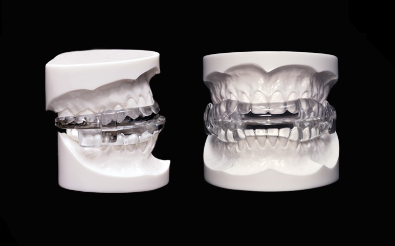 Sleep Apnea Treatments at Montrose Dental Sleep Apnea Treatments at Montrose Dental