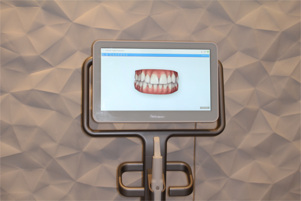 Digital scanners at Montrose Dental