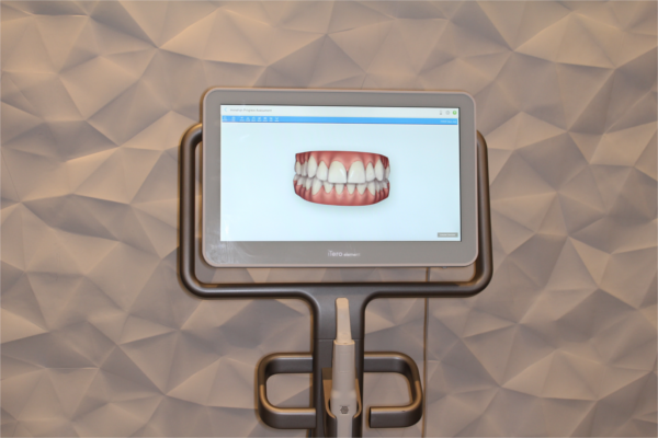 Digital scanners at Montrose Dental Digital scanners at Montrose Dental